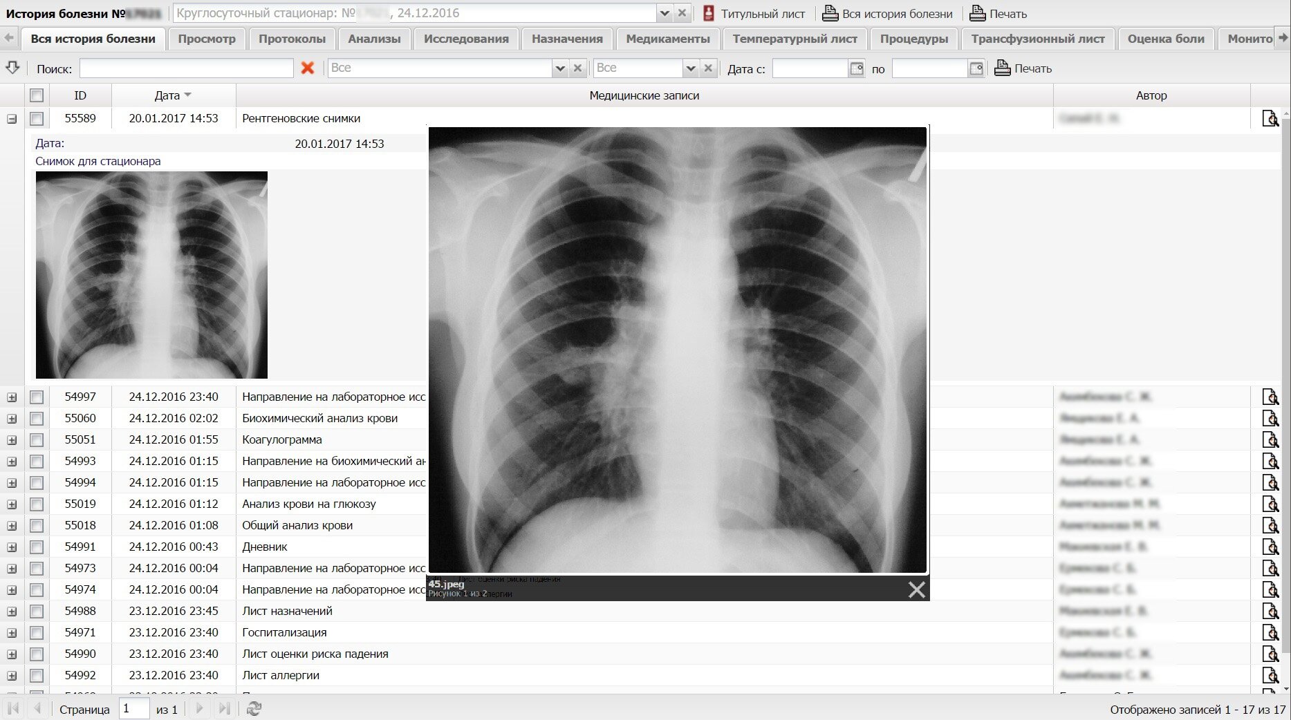 Рентгеновский снимок Рентгеновский снимок